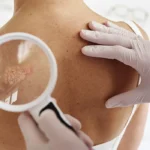 Dermatologista