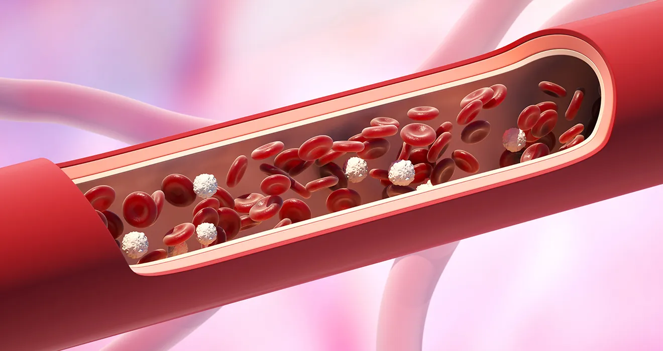 Cirurgia vascular Cirurgia vascular