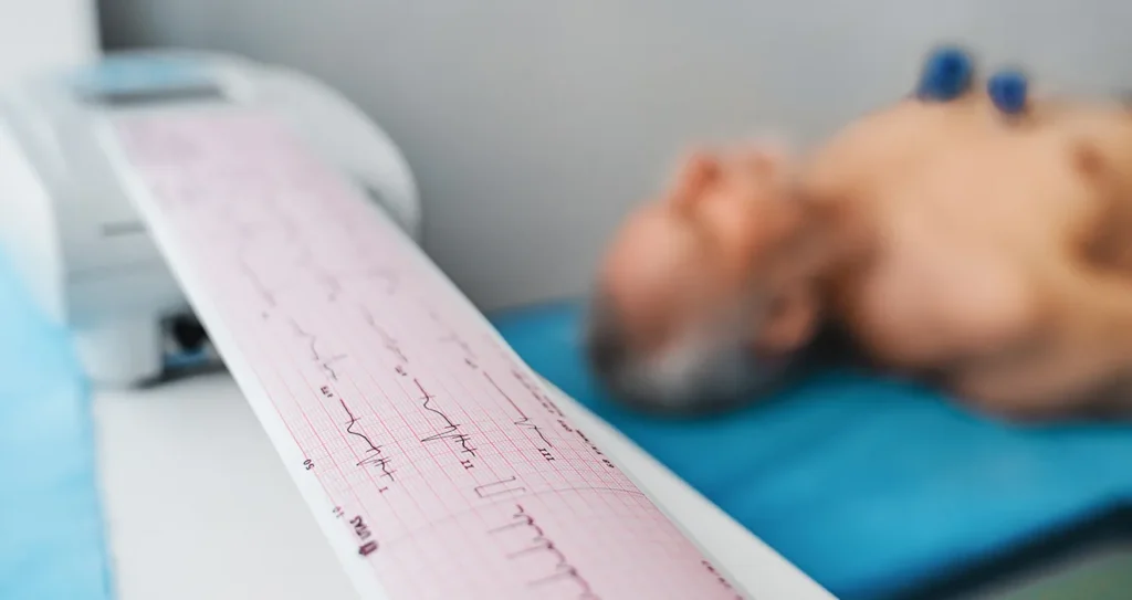 Eletrocardiograma ECG